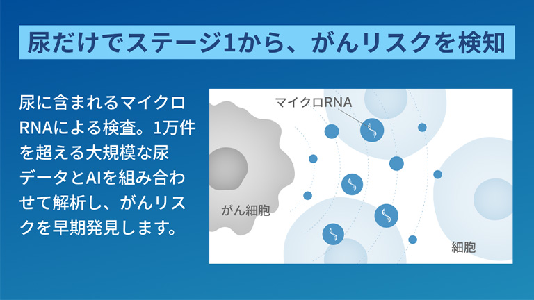 尿だけでステージ1から、がんリスクを検知 尿に含まれるマイクロRNAによる検査。1万件を超える大規模な尿データとAIを組み合わせて解析し、がんリスクを早期発見します。